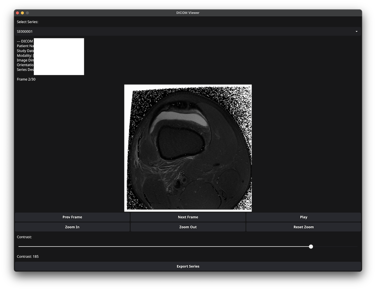 Dicom MRI Viewer